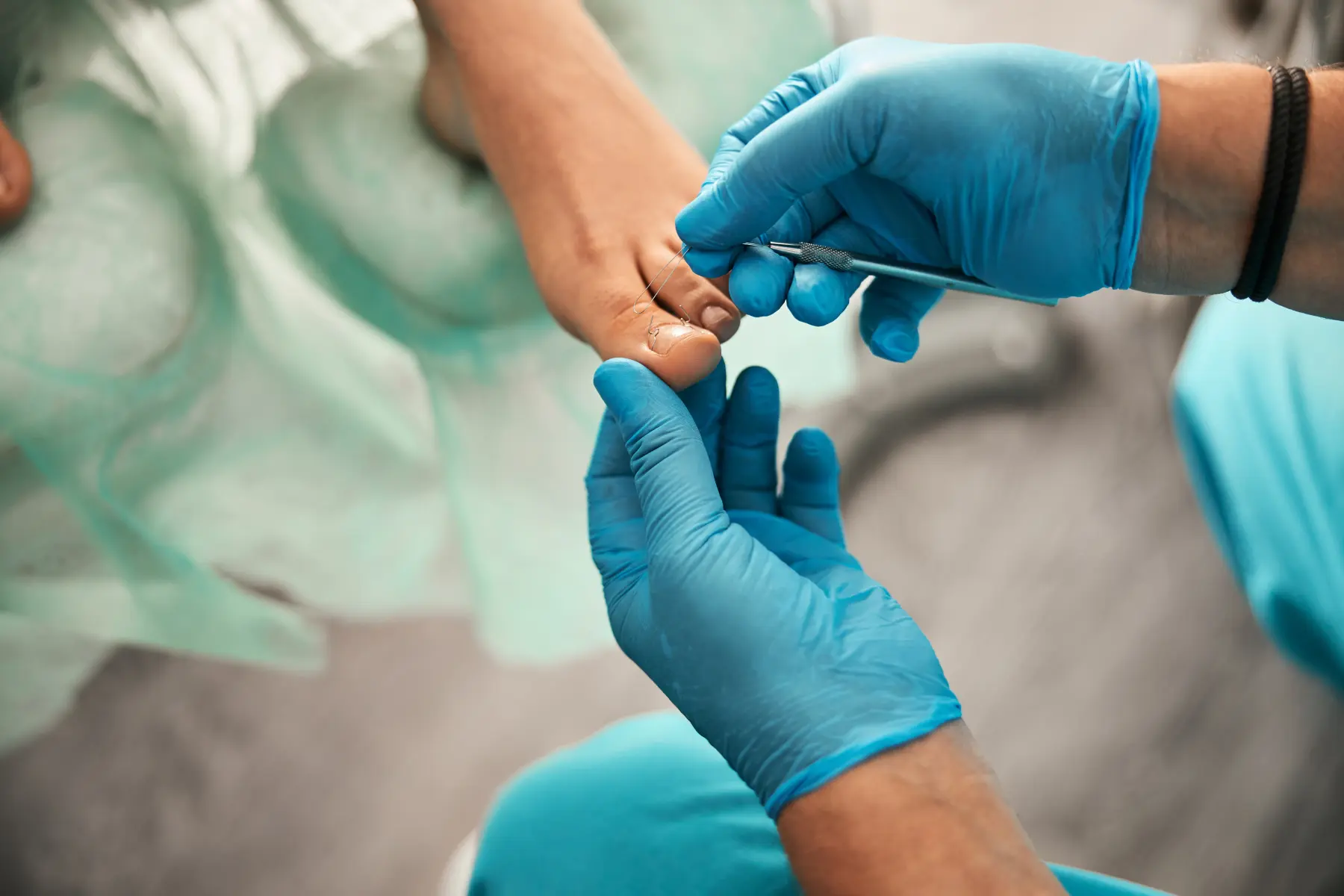 Nail Surgery London